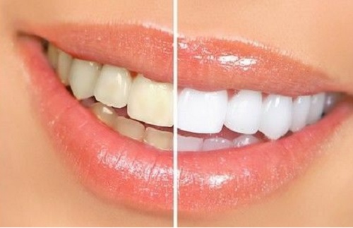 Pastă de dinţi AP-24® cu Fluor pentru înălbirea dinţilor
